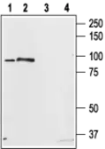 Anti-STIM2 antibody used in Western Blot (WB). GTX54768