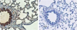 Anti-CFTR antibody used in IHC (Paraffin sections) (IHC-P). GTX54774