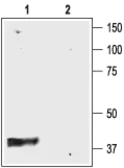 Anti-Kir4.1 antibody used in Western Blot (WB). GTX54781