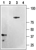 Anti-P2Y12 antibody used in Western Blot (WB). GTX54796