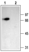 Anti-ACCN1 antibody used in Western Blot (WB). GTX54802
