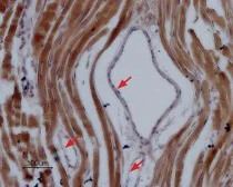 Anti-Nav1.5 antibody used in IHC (Paraffin sections) (IHC-P). GTX54803