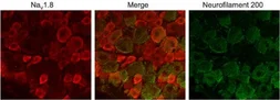 Anti-Nav1.8 antibody used in IHC (Frozen sections) (IHC-Fr). GTX54805
