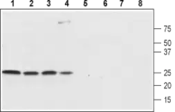 Anti-SCN4B antibody used in Western Blot (WB). GTX54810