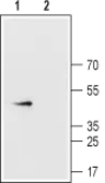 Anti-Connexin 43 antibody used in Western Blot (WB). GTX54818