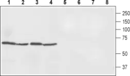 Anti-Ferroportin 1 antibody used in Western Blot (WB). GTX54821