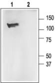 Anti-Maxi Potassium channel alpha antibody used in Western Blot (WB). GTX54828