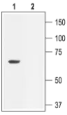 Anti-KCNN2 antibody used in Western Blot (WB). GTX54829