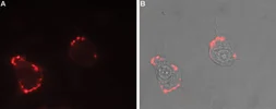 Anti-Neurexin 1 antibody used in Live cell imaging (LCI). GTX54845