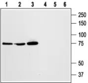 Anti-STIM1 antibody used in Western Blot (WB). GTX54855