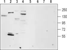 Anti-TRPM4 antibody used in Western Blot (WB). GTX54863