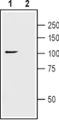 Anti-TRPC1 antibody used in Western Blot (WB). GTX54876