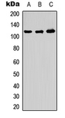 Anti-ADAMTS10 antibody used in Western Blot (WB). GTX54884