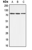 Anti-ABCB10 antibody used in Western Blot (WB). GTX54895