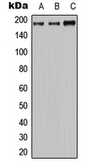 Anti-MRP2 antibody used in Western Blot (WB). GTX54899