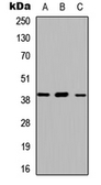Anti-ABHD13 antibody used in Western Blot (WB). GTX54900