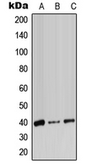 Anti-ADH7 antibody used in Western Blot (WB). GTX54902