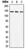 Anti-c-Abl antibody used in Western Blot (WB). GTX54905