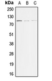 Anti-alpha Actinin 3 antibody used in Western Blot (WB). GTX54908