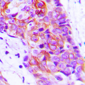 Anti-ADCY9 antibody used in IHC (Paraffin sections) (IHC-P). GTX54909