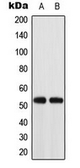 Anti-ACOT2 antibody used in Western Blot (WB). GTX54912