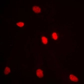 Anti-ADAR2 antibody used in Immunocytochemistry/ Immunofluorescence (ICC/IF). GTX54916