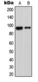 Anti-ADAM23 antibody used in Western Blot (WB). GTX54917