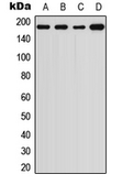 Anti-alpha 2 Macroglobulin antibody used in Western Blot (WB). GTX54918