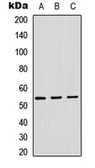 Anti-ADAMDEC1 antibody used in Western Blot (WB). GTX54922