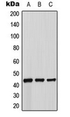 Anti-beta 3 Adrenergic Receptor antibody used in Western Blot (WB). GTX54925