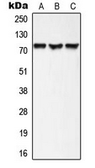 Anti-AKAP10 antibody used in Western Blot (WB). GTX54934