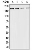 Anti-ACE antibody used in Western Blot (WB). GTX54938