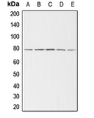 Anti-gamma Adducin antibody used in Western Blot (WB). GTX54942
