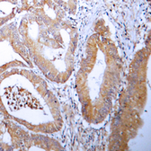 Anti-Acetyl-CoA Carboxylase 1 antibody used in IHC (Paraffin sections) (IHC-P). GTX54946