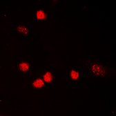 Anti-p53 (Acetyl Lys319) antibody used in Immunocytochemistry/ Immunofluorescence (ICC/IF). GTX54949