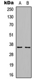 Anti-Cyclin D1 (phospho Thr286) antibody used in Western Blot (WB). GTX54957