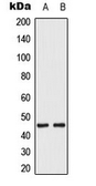 Anti-MEK1/2 (phospho Ser222/Ser226) antibody used in Western Blot (WB). GTX54969