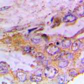 Anti-CaMK1 (phospho Thr177) antibody used in IHC (Paraffin sections) (IHC-P). GTX54970