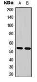Anti-PTEN (phospho Ser370) antibody used in Western Blot (WB). GTX54979