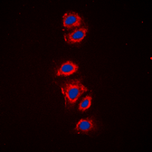 Anti-RPS6 (phospho Ser240) antibody used in Immunocytochemistry/ Immunofluorescence (ICC/IF). GTX54985