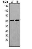 Anti-SHC1 (phospho Tyr239) antibody used in Western Blot (WB). GTX54986