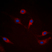 Anti-alpha Synuclein (phospho Ser129) antibody used in Immunocytochemistry/ Immunofluorescence (ICC/IF). GTX54991