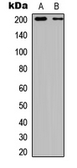 Anti-TSC2 (phospho Ser939) antibody used in Western Blot (WB). GTX54996