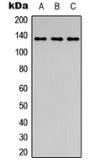 Anti-c-Abl (phospho Tyr204) antibody used in Western Blot (WB). GTX54998