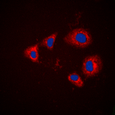 Anti-Aurora A (phospho Thr288) antibody used in Immunocytochemistry/ Immunofluorescence (ICC/IF). GTX55002