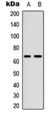 Anti-CDC25B (phospho Ser323) antibody used in Western Blot (WB). GTX55005