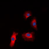 Anti-IGF1R (phospho Tyr1131) / Insulin Receptor (phospho Tyr1146) antibody used in Immunocytochemistry/ Immunofluorescence (ICC/IF). GTX55013