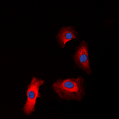 Anti-IGF1R beta (phospho Tyr1131) / Insulin Receptor beta (phospho Tyr1146) antibody used in Immunocytochemistry/ Immunofluorescence (ICC/IF). GTX55013