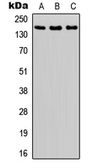 Anti-ASK1 (phospho Ser966) antibody used in Western Blot (WB). GTX55019