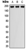 Anti-PDGF Receptor beta (phospho Tyr751) antibody used in Western Blot (WB). GTX55024